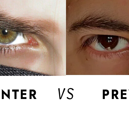 hunter eyes vs prey eyes